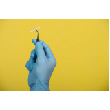 implante hormonal feminino procedimento Costa Azul