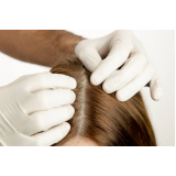 tratamento para engrossar os fios do cabelo marcar Imbuí